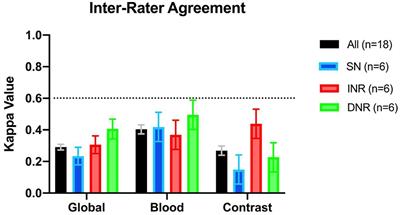 Is This Contrast? Is This Blood? An Agreement Study on Post-thrombectomy Computed Tomography Scans